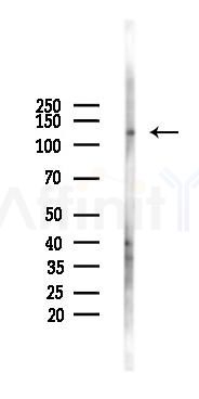 PERK Antibody - Western blot analysis of lysates from B16F10-LUC cells(LPS 4h treatment), using PERK Antibody at 1/1000 dilution.