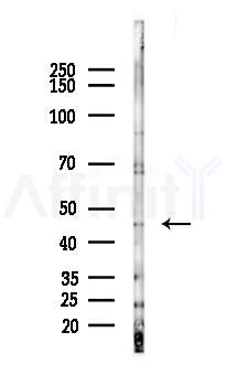 CRHR1 Antibody - Western blot analysis of lysates from 293 cells(heat-shock 45min treatment), using CRHR1 Antibody at 1/1000 dilution.