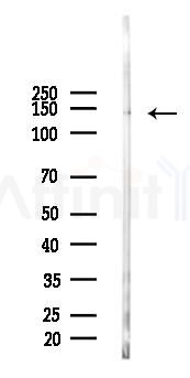MLCK Antibody - Western blot analysis of lysates from Mouse lung, using MLCK Antibody at 1/1000 dilution.