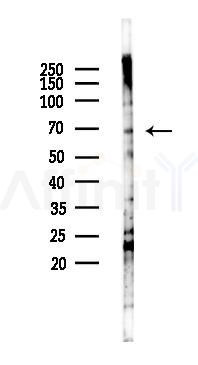 MMP2 Antibody - Western blot analysis of lysates from A2780 cells(LPS 4h treatment), using MMP2 Antibody at 1/1000 dilution.