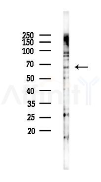 MMP2 Antibody - Western blot analysis of lysates from 293 cells(heat-shock 45min treatment), using MMP2 Antibody at 1/1000 dilution.
