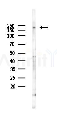 Fibronectin Antibody - Western blot analysis of lysates from Hela cells(starvation 24h treatment), using Fibronectin Antibody at 1/1000 dilution.