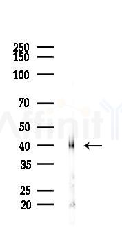 CD40 Antibody - Western blot analysis of lysates from A2780 cells(LPS 4h treatment), using CD40 Antibody at 1/1000 dilution.