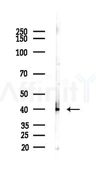 CD40 Antibody - Western blot analysis of lysates from 293 cells(heat-shock 45min treatment), using CD40 Antibody at 1/1000 dilution.