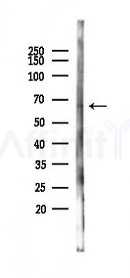 FAP Antibody - Western blot analysis of lysates from Rat kidney, using FAP1 Antibody at 1/1000 dilution.