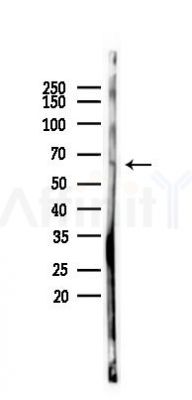 FAP Antibody - Western blot analysis of lysates from COLO205 cells(UV 30min treatment), using FAP1 Antibody at 1/1000 dilution.