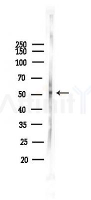 TGFBR1 Antibody - Western blot analysis of lysates from A2780 cells(LPS 4h treatment), using TGFBR1 Antibody at 1/1000 dilution.