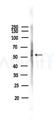 TGFBR1 Antibody - Western blot analysis of lysates from 293 cells(heat-shock 45min treatment), using TGFBR1 Antibody at 1/1000 dilution.