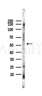 c-Fos Antibody - Western blot analysis of lysates from HUVEC cells(starvation 24h treatment), using c-Fos Antibody at 1/1000 dilution.
