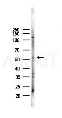 MMP13 Antibody - Western blot analysis of lysates from Rat testis, using MMP13 Antibody at 1/1000 dilution.