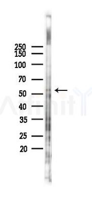 MMP13 Antibody - Western blot analysis of lysates from COLO205 cells(UV 30min treatment), using MMP13 Antibody at 1/1000 dilution.