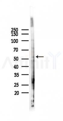 MMP13 Antibody - Western blot analysis of lysates from A2780 cells(LPS 4h treatment), using MMP13 Antibody at 1/1000 dilution.