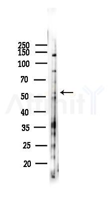 MMP13 Antibody - Western blot analysis of lysates from 293 cells(heat-shock 45min treatment), using MMP13 Antibody at 1/1000 dilution.