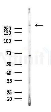 KAT3B/p300 Antibody - Western blot analysis of lysates from A2780 cells(LPS 4h treatment), using KAT3B/p300 Antibody at 1/1000 dilution.