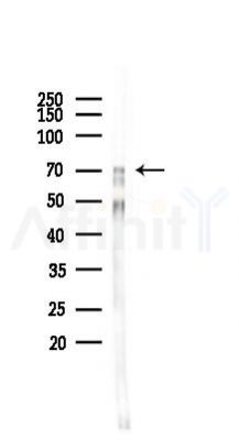 GRP78 Antibody - Western blot analysis of lysates from Rat liver, using GRP78 Antibody at 1/1000 dilution.