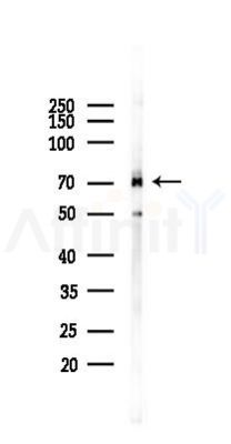 GRP78 Antibody - Western blot analysis of lysates from COLO205 cells(UV 30min treatment), using GRP78 Antibody at 1/1000 dilution.