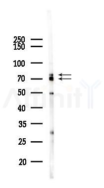 GRP78 Antibody - Western blot analysis of lysates from HUVEC cells(starvation 24h treatment), using GRP78 Antibody at 1/1000 dilution.
