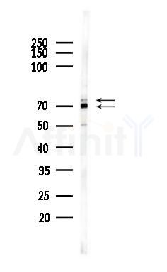 GRP78 Antibody - Western blot analysis of lysates from 293 cells(heat-shock 45min treatment), using GRP78 Antibody at 1/1000 dilution.