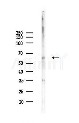 SQSTM1/p62 Antibody - Western blot analysis of lysates from RAW264.