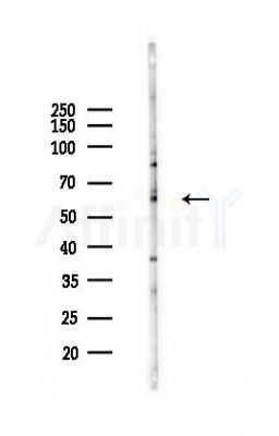 SQSTM1/p62 Antibody - Western blot analysis of lysates from HUVEC cells(heat-shock 45min treatment), using SQSTM1/p62 Antibody at 1/1000 dilution.