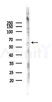 SQSTM1/p62 Antibody - Western blot analysis of lysates from PC12 cells(UV 30min treatment), using SQSTM1/p62 Antibody at 1/1000 dilution.