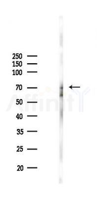 PGC1 Antibody - Western blot analysis of lysates from Mouse lung(70℃变性 treatment), using PGC1 alpha Antibody at 1/1000 dilution.