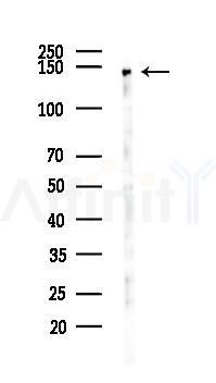 PGC1 Antibody - Western blot analysis of lysates from Hela cells(starvation 24h treatment), using PGC1 alpha Antibody at 1/1000 dilution.