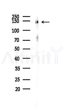 PGC1 Antibody - Western blot analysis of lysates from A2780 cells(LPS 4h treatment), using PGC1 alpha Antibody at 1/1000 dilution.