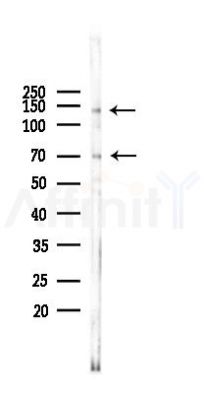 PGC1 Antibody - Western blot analysis of lysates from HUVEC cells(starvation 24h treatment), using PGC1 alpha Antibody at 1/1000 dilution.