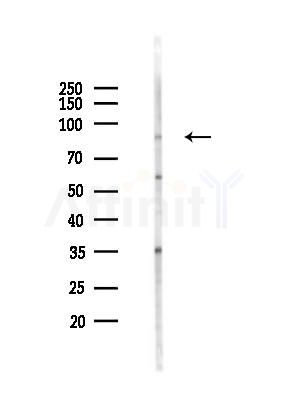 ATRIP Antibody - Western blot analysis of lysates from HUVEC cells(heat-shock 45min treatment), using ATRIP Antibody at 1/1000 dilution.