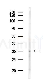 Phospho-Annexin A2 (Ser26) Antibody - Western blot analysis of lysates from EC304 cells(UV 30min treatment), using Phospho-Annexin A2 (Ser26) Antibody at 1/1000 dilution.
