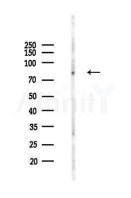 TNF Receptor II Antibody - Western blot analysis of lysates from HUVEC cells(heat-shock 45min treatment), using TNF Receptor II Antibody at 1/1000 dilution.