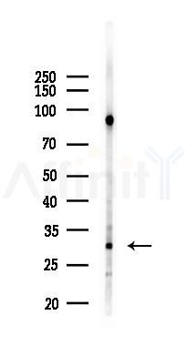 VDAC1 Antibody - Western blot analysis of lysates from PC12 cells(LPS 4h treatment), using VDAC1 Antibody at 1/1000 dilution.