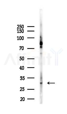 VDAC1 Antibody - Western blot analysis of lysates from K562 cells(heat-shock 45min treatment), using VDAC1 Antibody at 1/1000 dilution.