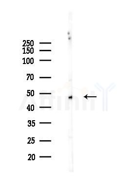 ACV1B Antibody - Western blot analysis of lysates from HUVEC cells(heat-shock 45min treatment), using ACV1B Antibody at 1/1000 dilution.