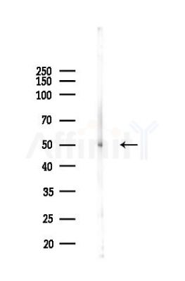 Chk1 Antibody - Western blot analysis of lysates from Rat lung, using Chk1 Antibody at 1/1000 dilution.