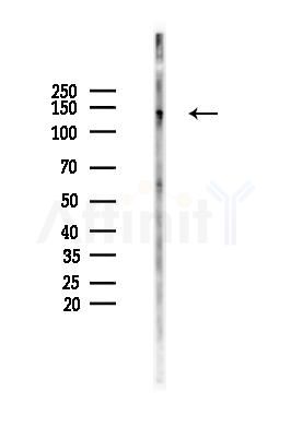 JAK2 Antibody - Western blot analysis of lysates from Mouse lung, using JAK2 Antibody at 1/1000 dilution.
