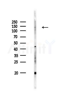 JAK2 Antibody - Western blot analysis of lysates from PC12 cells(UV 30min treatment), using JAK2 Antibody at 1/1000 dilution.