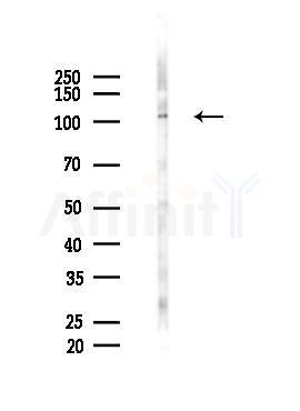 JAK2 Antibody - Western blot analysis of lysates from COLO205 cells(starvation 24h treatment), using JAK2 Antibody at 1/1000 dilution.