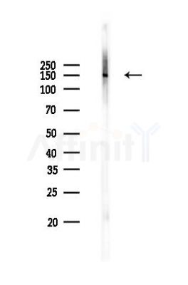 EGFR Antibody - Western blot analysis of lysates from Mouse brain, using EGFR Antibody at 1/1000 dilution.