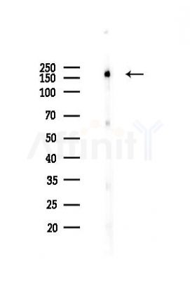 EGFR Antibody - Western blot analysis of lysates from HUVEC cells(heat-shock 45min treatment), using EGFR Antibody at 1/1000 dilution.