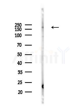 EGFR Antibody - Western blot analysis of lysates from HUVEC cells(heat-shock 45min treatment), using EGFR Antibody at 1/1000 dilution.