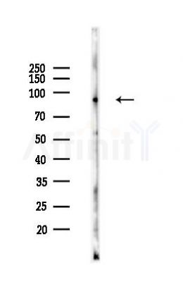 NR3C1 Antibody - Western blot analysis of lysates from HUVEC cells(heat-shock 45min treatment), using NR3C1 Antibody at 1/1000 dilution.