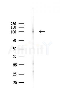 Integrin beta3 Antibody - Western blot analysis of lysates from Rat lung, using Integrin beta3 Antibody at 1/1000 dilution.
