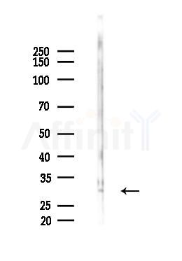 CDK1/CDC2 Antibody - Western blot analysis of lysates from COLO205 cells(starvation 24h treatment), using CDK1/CDC2 Antibody at 1/1000 dilution.