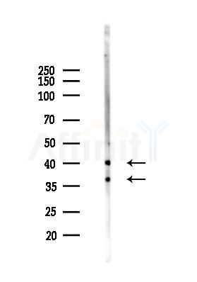 Nucleophosmin Antibody - Western blot analysis of lysates from HUVEC cells(heat-shock 45min treatment), using Nucleophosmin Antibody at 1/1000 dilution.