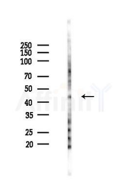 MCSF Receptor Antibody - Western blot analysis of lysates from K562 cells(UV 30min treatment), using MCSF Receptor Antibody at 1/1000 dilution.