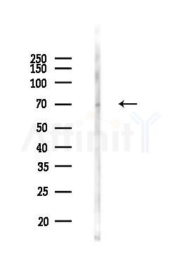 ADRB2 Antibody - Western blot analysis of lysates from Rat brain, using ADRB2 Antibody at 1/1000 dilution.