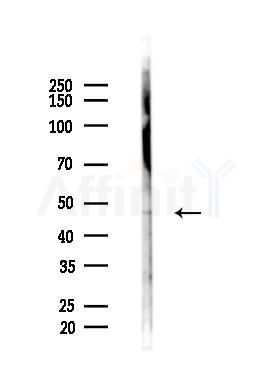 ADRB2 Antibody - Western blot analysis of lysates from COLO205 cells(starvation 24h treatment), using ADRB2 Antibody at 1/1000 dilution.
