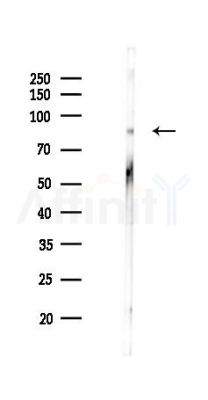 IGF1 Receptor Antibody - Western blot analysis of lysates from HUVEC cells(LPS 4h treatment), using IGF1 Receptor Antibody at 1/1000 dilution.